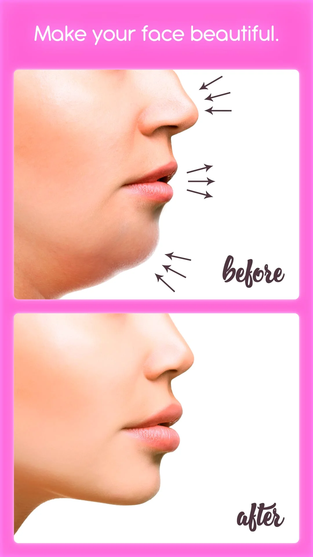 Rhinoplasty Screenshot 1
