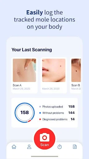 AI Dermatologist: Skin Scanner Screenshot 3
